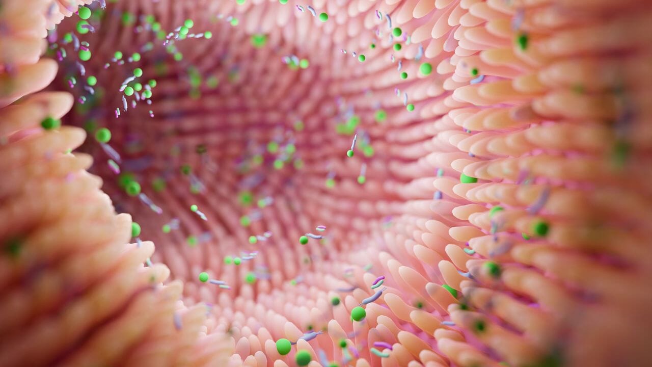 flora-intestinal-extracto-de-olmo-suplemento-para-que-sirve
