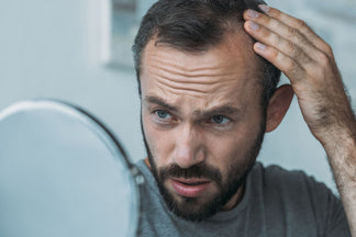 Alopecia masculina: causas, tipos y cómo prevenir la caída del cabello con Haar Forte Gold Pro Man